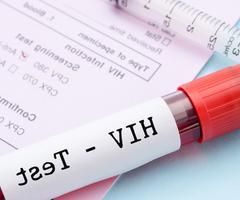 HIV Testing Should be Part of Routine 健康 Screening